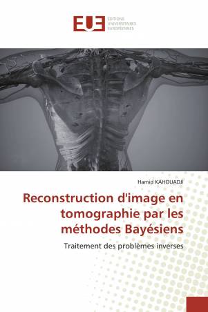 Reconstruction d'image en tomographie par les méthodes Bayésiens