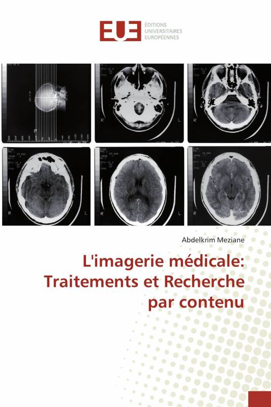 L'imagerie médicale: Traitements et Recherche par contenu