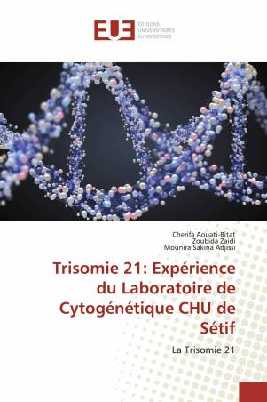 Trisomie 21: Expérience du Laboratoire de Cytogénétique CHU de Sétif