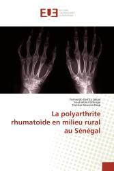 La polyarthrite rhumatoïde en milieu rural au Sénégal