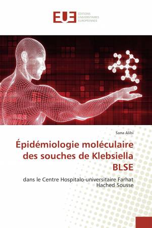 Épidémiologie moléculaire des souches de Klebsiella BLSE