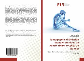 Tomographie d’Emission MonoPhotonique au 99mTc-HMDP couplée au scanner
