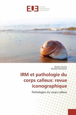 IRM et pathologie du corps calleux: revue iconographique