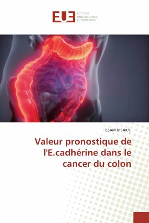 Valeur pronostique de l&#039;E.cadhérine dans le cancer du colon