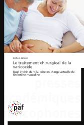 Le traitement chirurgical de la varicocèle