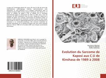 Evolution du Sarcome de Kaposi aux C.U de Kinshasa de 1989 à 2008
