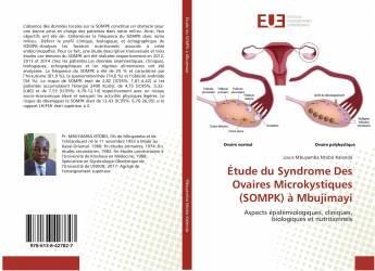 Étude du Syndrome Des Ovaires Microkystiques (SOMPK) à Mbujimayi