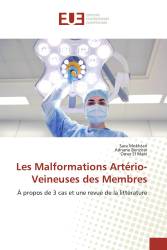 Les Malformations Artério-Veineuses des Membres