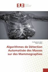 Algorithmes de Détection Automatisée des Masses sur des Mammographies