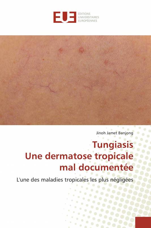 TungiasisUne dermatose tropicale mal documentée