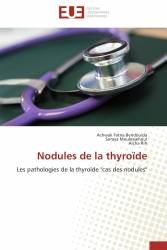 Nodules de la thyroïde