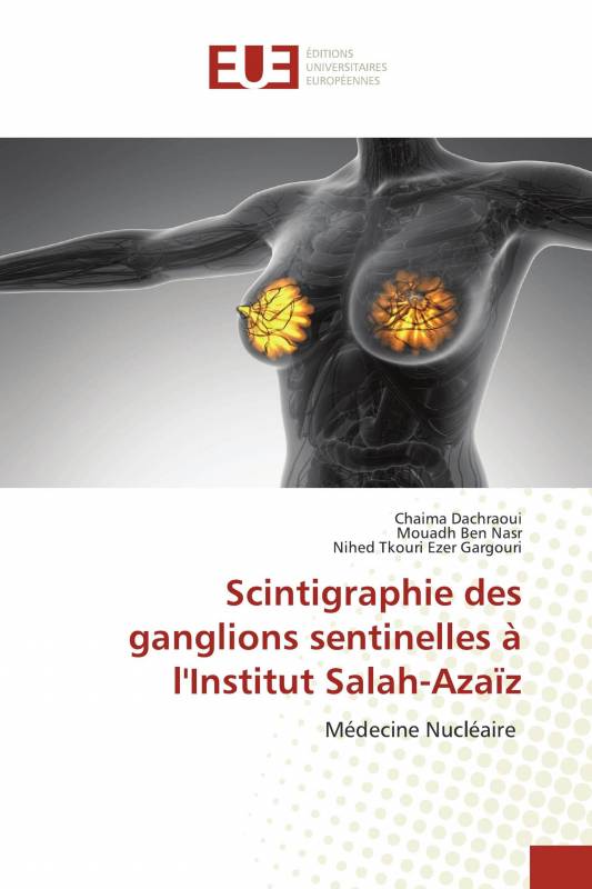 Scintigraphie des ganglions sentinelles à l'Institut Salah-Azaïz