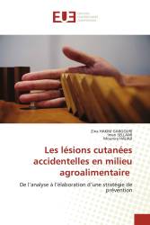 Les lésions cutanées accidentelles en milieu agroalimentaire