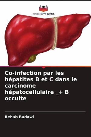 Co-infection par les hépatites B et C dans le carcinome hépatocellulaire _+ B occulte