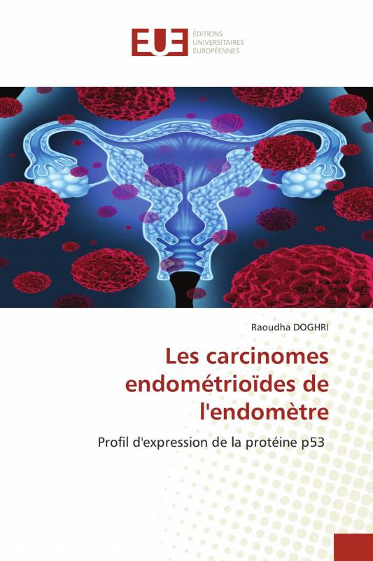 Les carcinomes endométrioïdes de l'endomètre