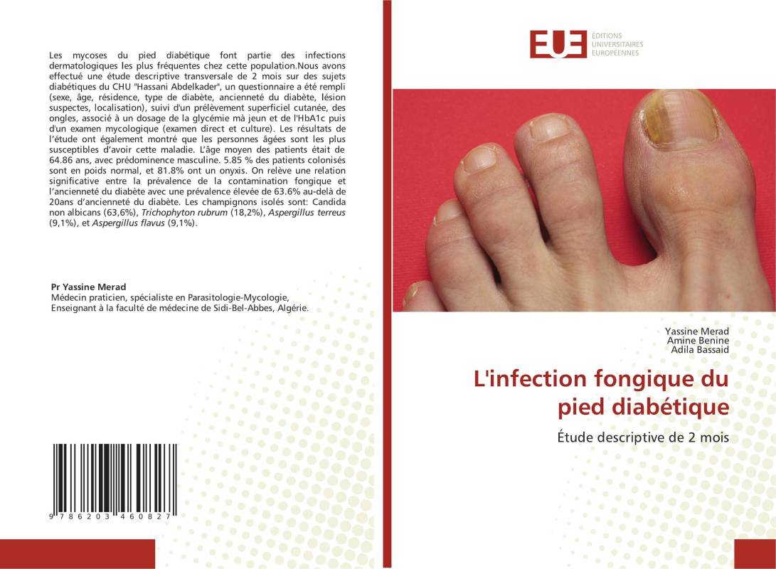 L'infection fongique du pied diabétique