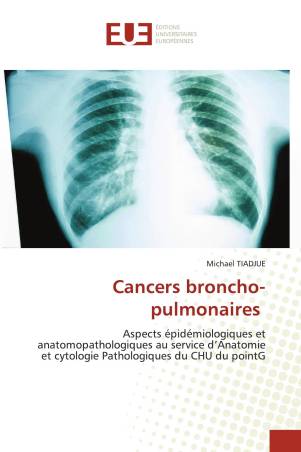 Cancers broncho-pulmonaires