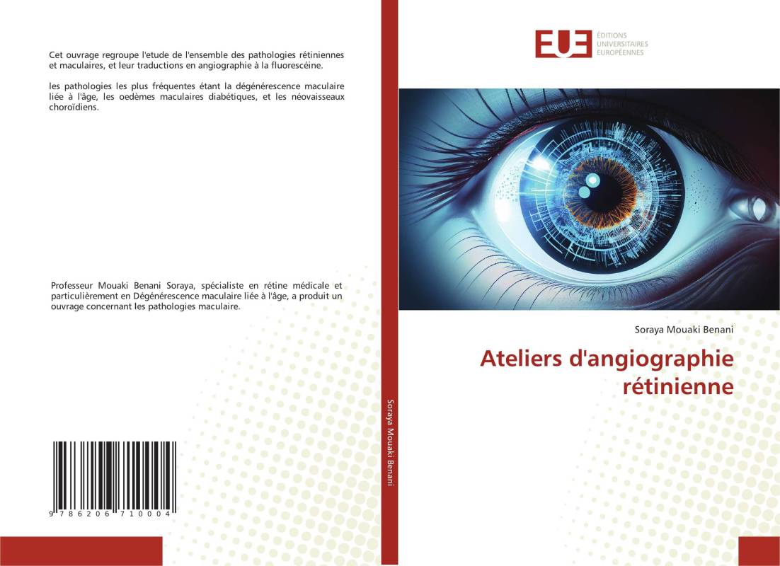 Ateliers d'angiographie rétinienne