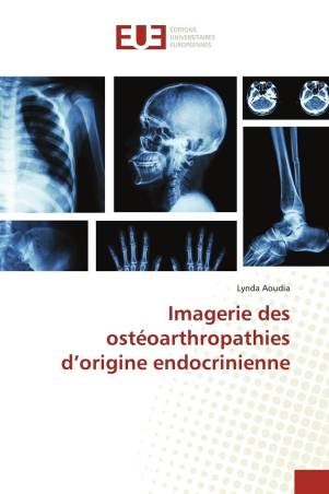 Imagerie des ostéoarthropathies d’origine endocrinienne