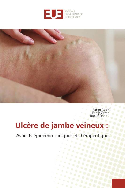 Ulcère de jambe veineux :