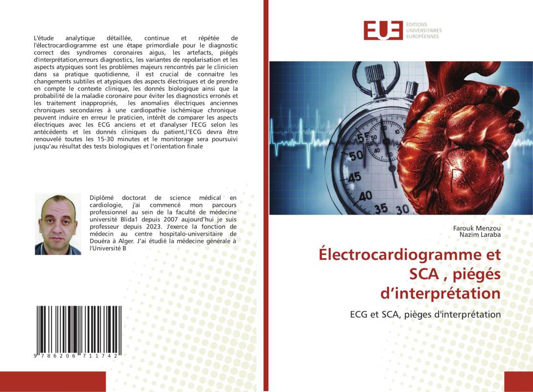 Électrocardiogramme et SCA , piégés d’interprétation