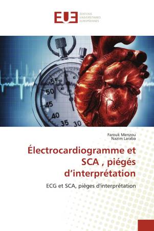 Électrocardiogramme et SCA , piégés d’interprétation