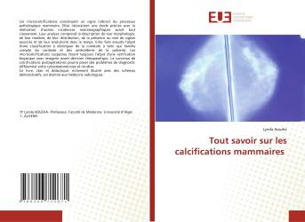 Tout savoir sur les calcifications mammaires