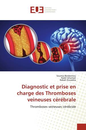 Diagnostic et prise en charge des Thromboses veineuses cérébrale