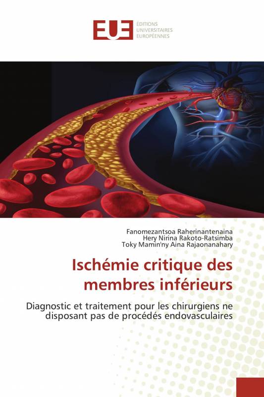 Ischémie critique des membres inférieurs