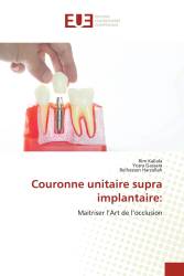 Couronne unitaire supra implantaire: