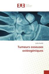 Tumeurs osseuses ostéogéniques