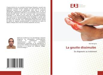 La goutte dissimulée