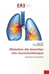 Dilatation des bronches non mucoviscidosique