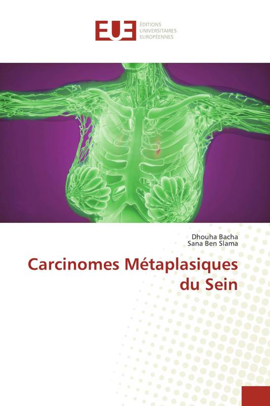 Carcinomes Métaplasiques du Sein