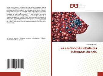 Les carcinomes lobulaires infiltrants du sein