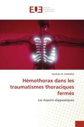 Hémothorax dans les traumatismes thoraciques fermés