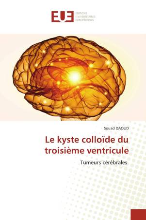 Le kyste colloïde du troisième ventricule