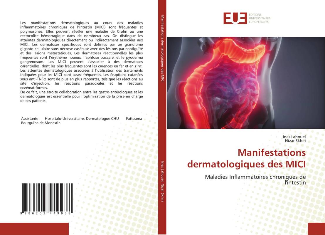 Manifestations dermatologiques des MICI