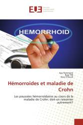 Hémorroïdes et maladie de Crohn