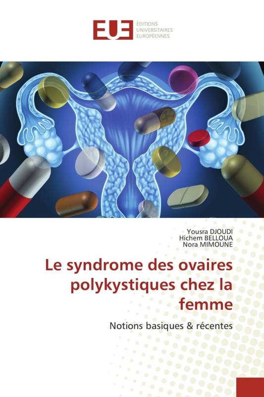 Le syndrome des ovaires polykystiques chez la femme