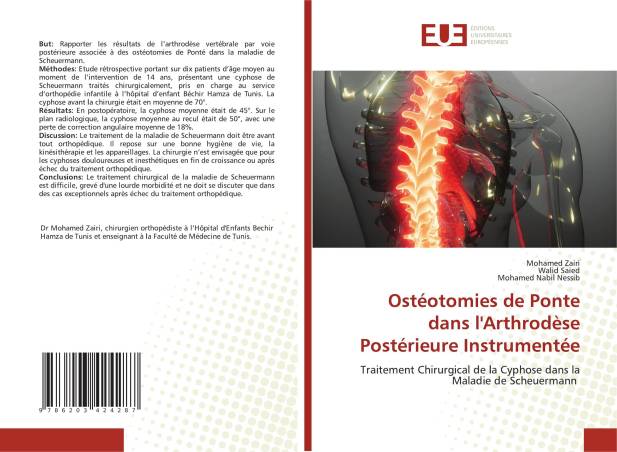 Ostéotomies de Ponte dans l&#039;Arthrodèse Postérieure Instrumentée