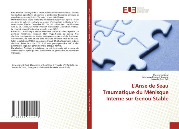 L&#039;Anse de Seau Traumatique du Ménisque Interne sur Genou Stable