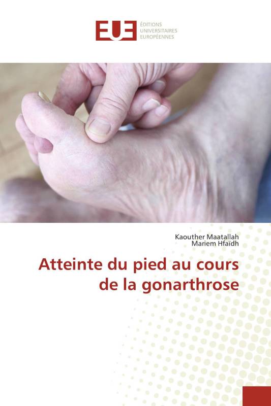 Atteinte du pied au cours de la gonarthrose