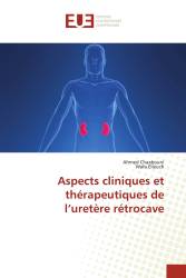 Aspects cliniques et thérapeutiques de l’uretère rétrocave