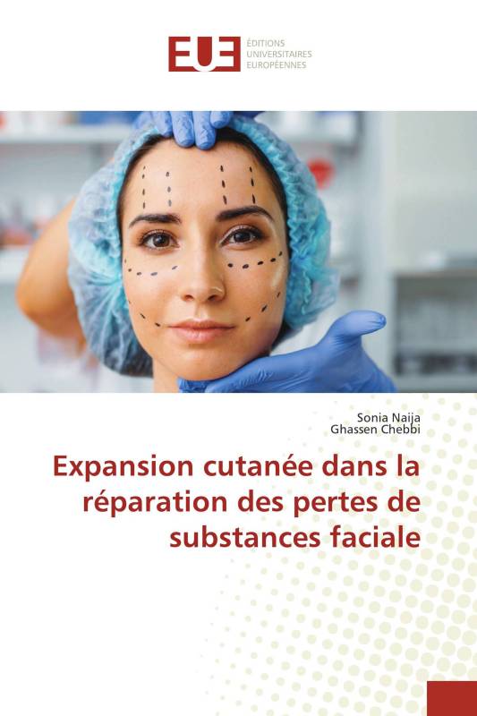 Expansion cutanée dans la réparation des pertes de substances faciale