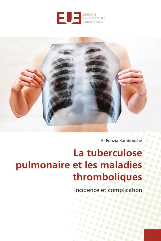 La tuberculose pulmonaire et les maladies thromboliques