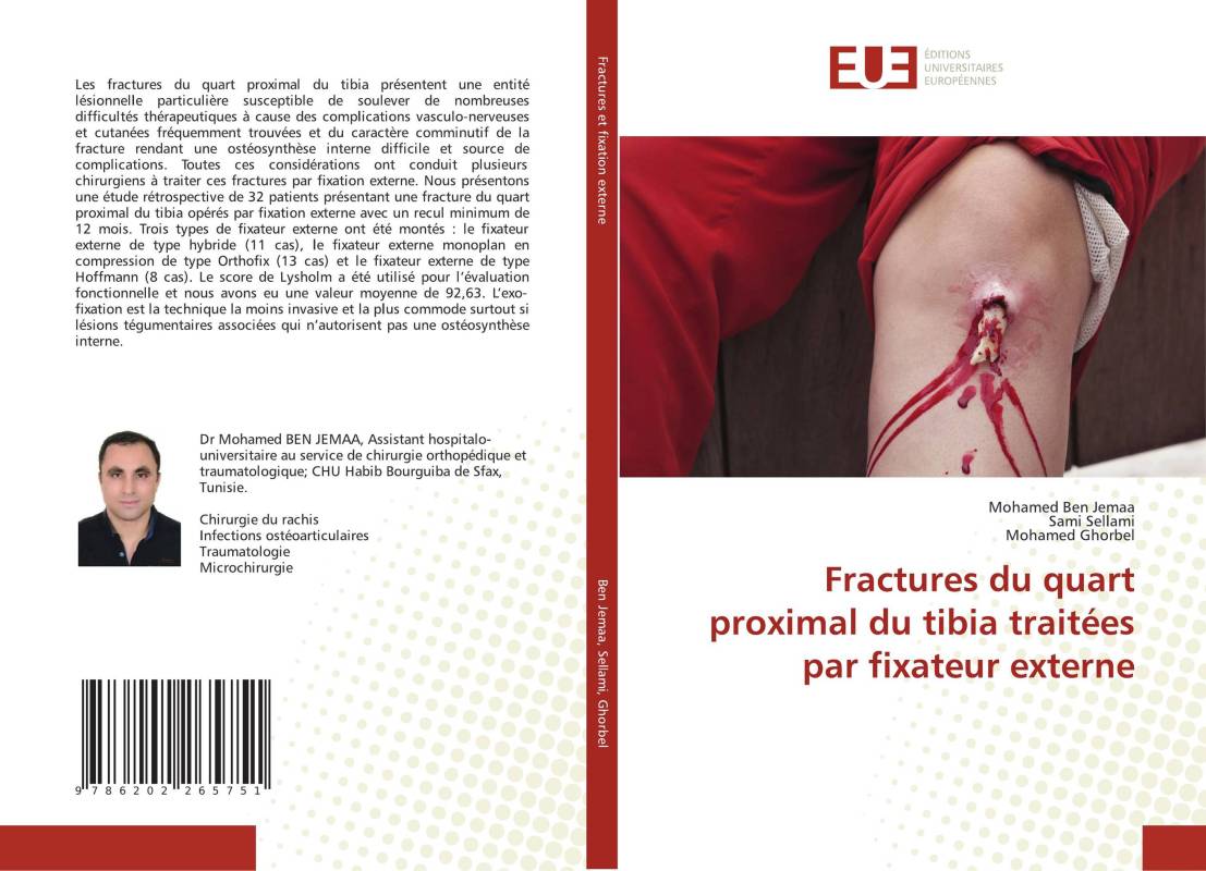 Fractures du quart proximal du tibia traitées par fixateur externe