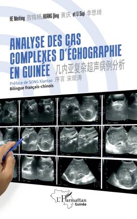 Analyse des cas complexes d'échographie en Guinée