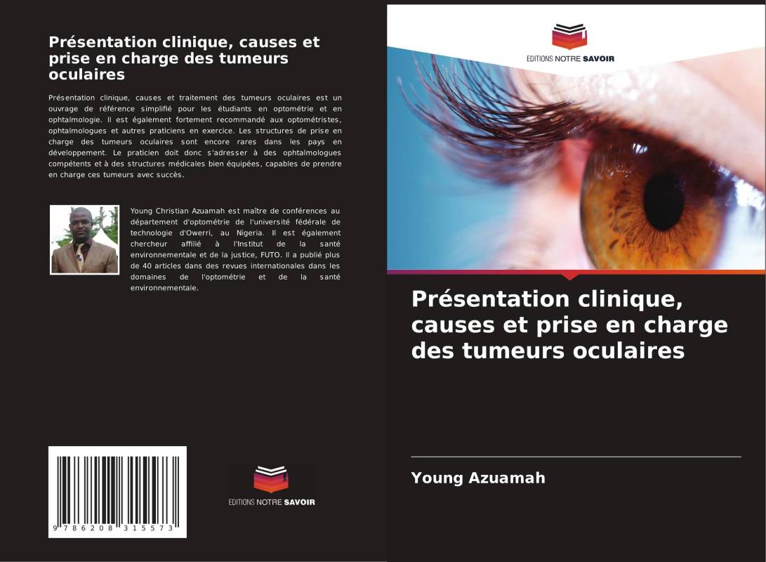 Présentation clinique, causes et prise en charge des tumeurs oculaires