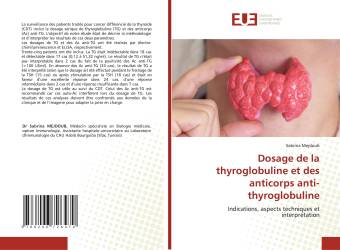 Dosage de la thyroglobuline et des anticorps anti-thyroglobuline